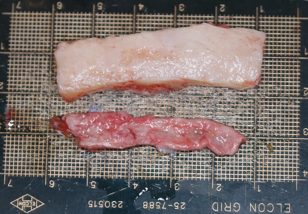 코끝 날개이식 임상 사진