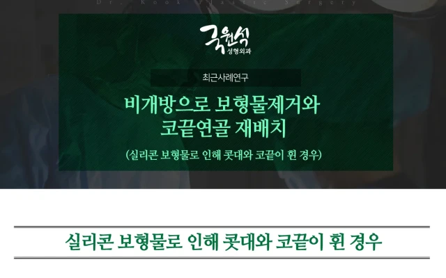 비개방으로 보형물제거와 코끝연골 재배치