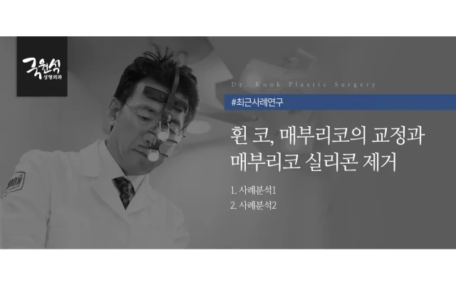 휜 코, 매부리코의 교정과 매부리코 실리콘 제거